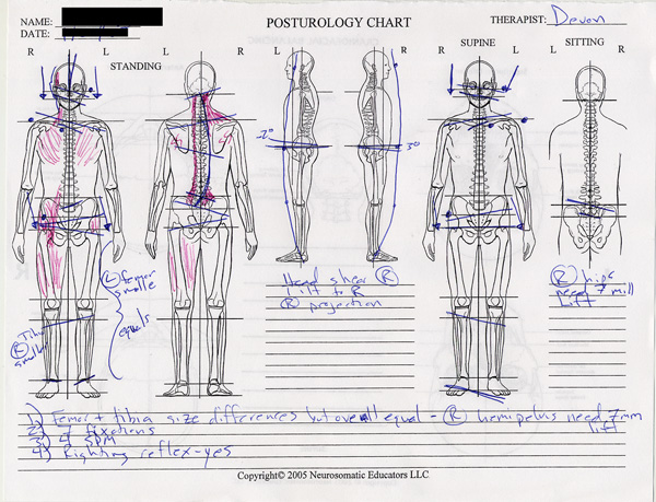 Example Posturology Chart